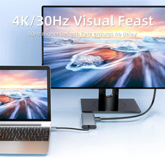 11-in-1 USB C Hub Docking Station, Type C Multiport Adapter with 4K HDMI@30Hz, VGA, USB 3.0 Ports, SD/Micro SD Card Reader, Gigabit Ethernet, USB-C Power Delivery for Laptop MacBook Pro Air Dell HP